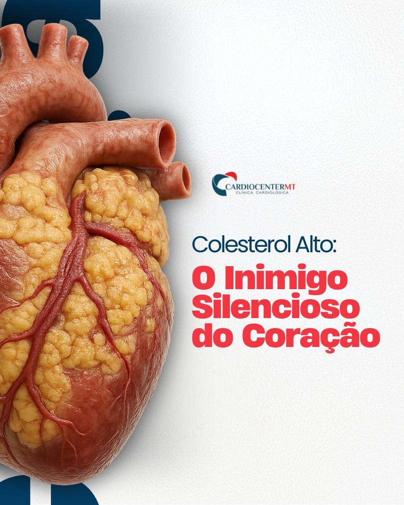 Colesterol Alto